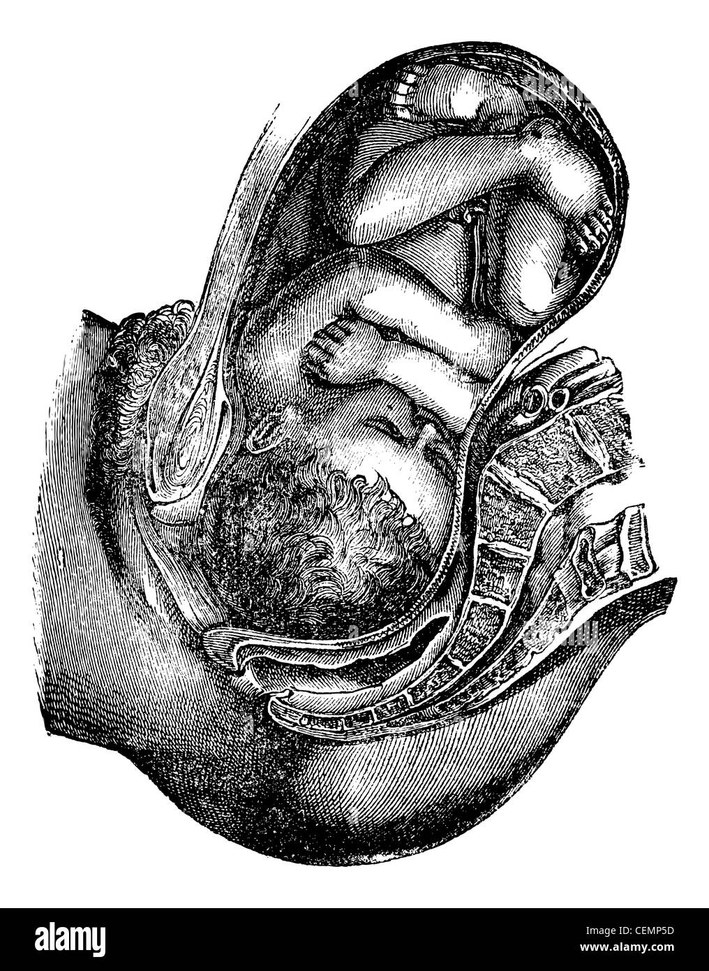 Engagement und Abstieg des Kopfes, graviert Vintage Illustration. Magasin Pittoresque 1875. Stockfoto