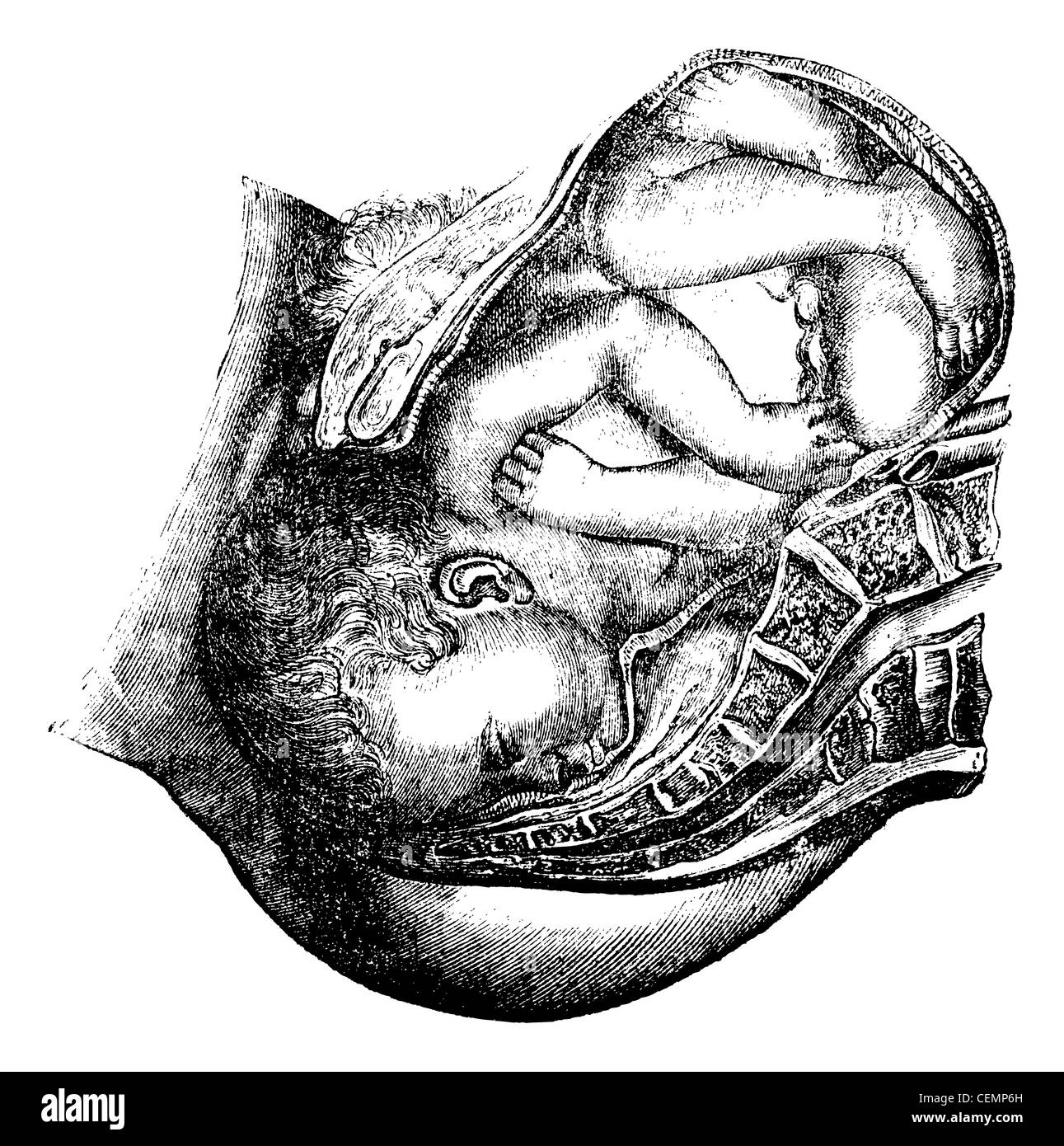 Lieferung des Kopfes, graviert Vintage Illustration. Magasin Pittoresque 1875. Stockfoto