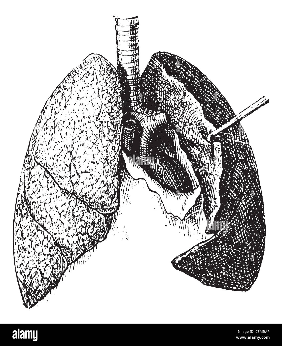 Alte eingraviertem Muster der menschlichen Lunge auf weißem Hintergrund isoliert. Wörterbuch der Wörter und Dinge - larive und Fleury? 1895 Stockfoto