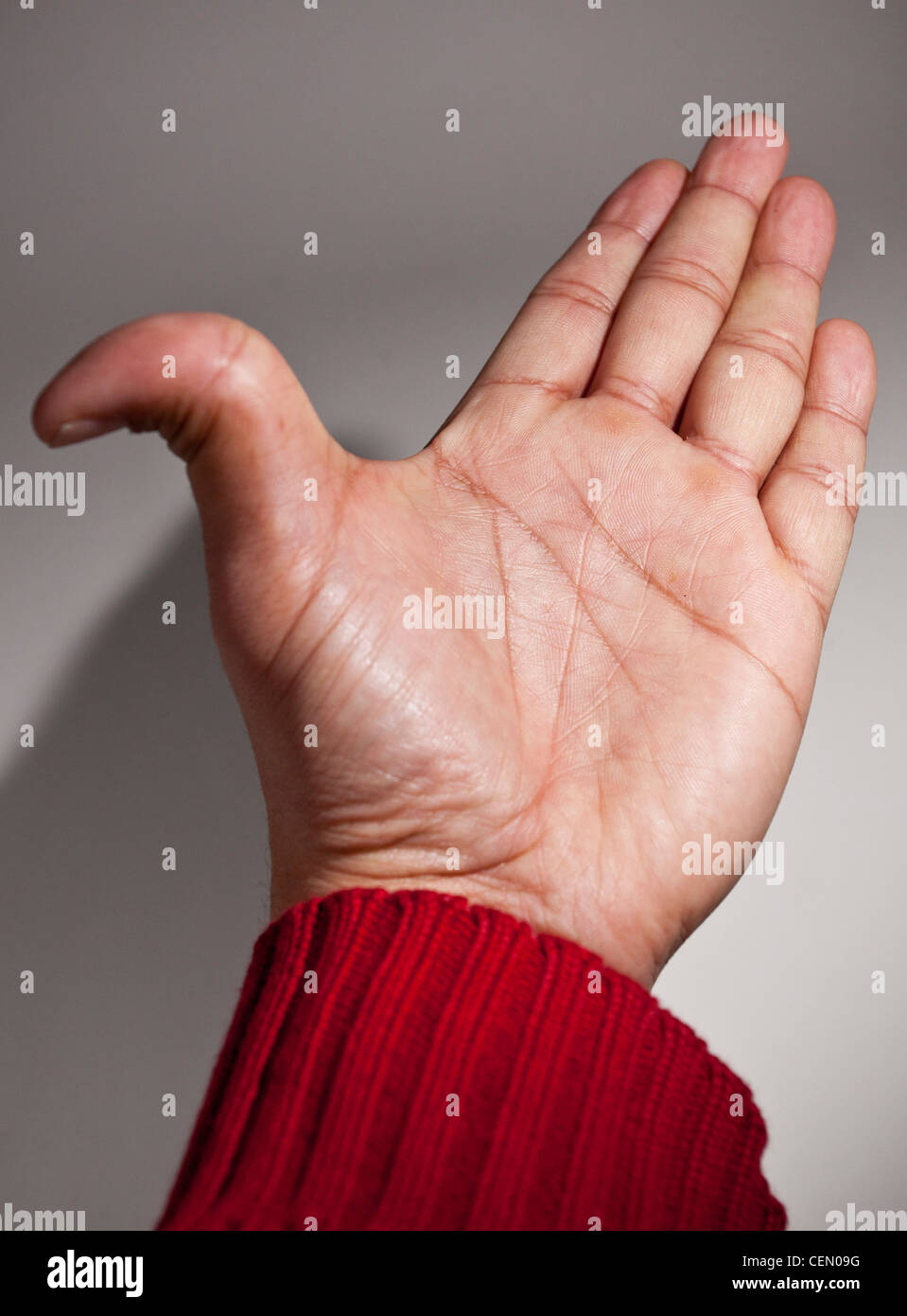 Hand mit doppelt gegliederte Daumen nach hinten gebogen (Hypermobilität) Ausschnitt ausschneiden. Stockfoto
