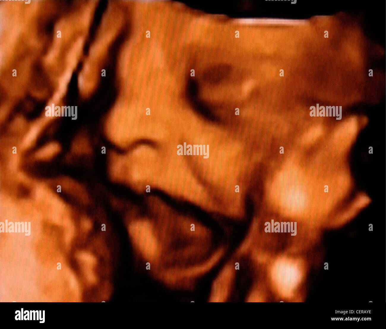 Ein 4D Ultraschallscan eines Fötus in der Gebärmutter Stockfoto