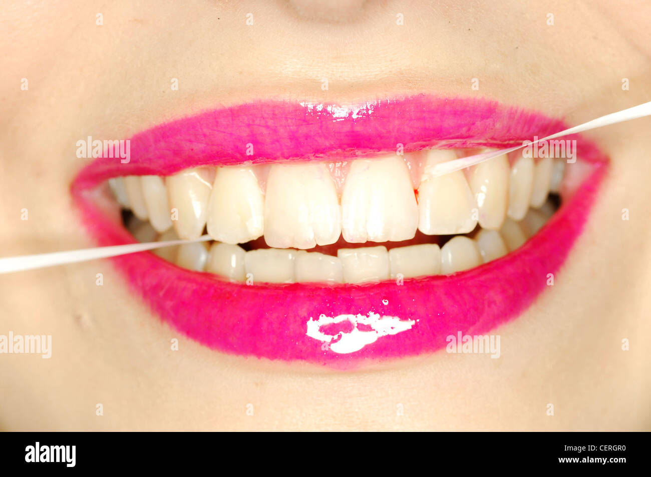 Nahaufnahme eines weiblichen Mund hell rosa Lipgloss mit Gewinde von Zahnseide durch Frontzähne Stockfoto
