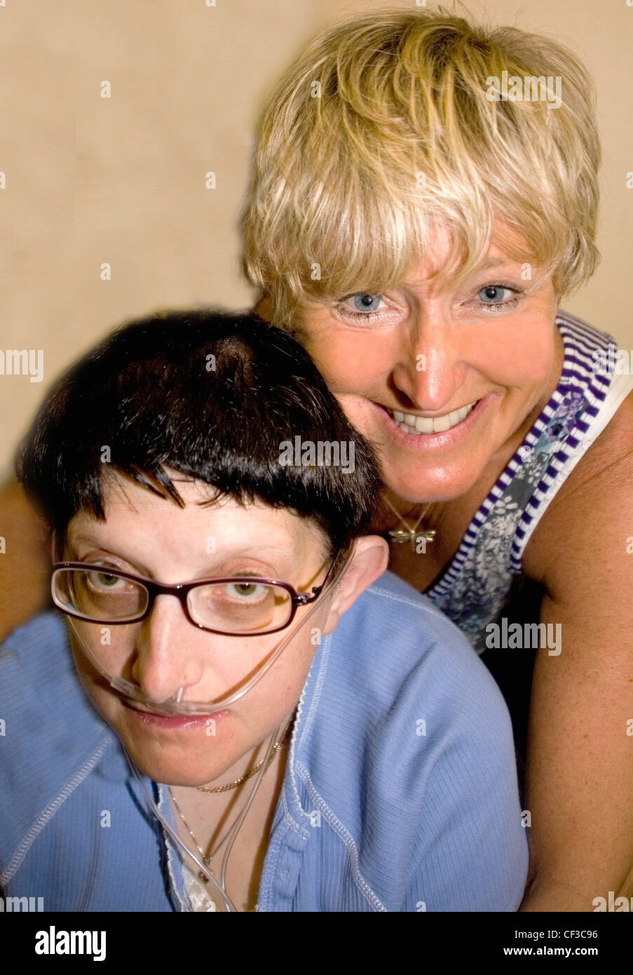 Zwei Freunde teilen eine Umarmung einer Frau mit einem Sauerstoff liefern Schlauch; Bolton, Lancashire, England Stockfoto