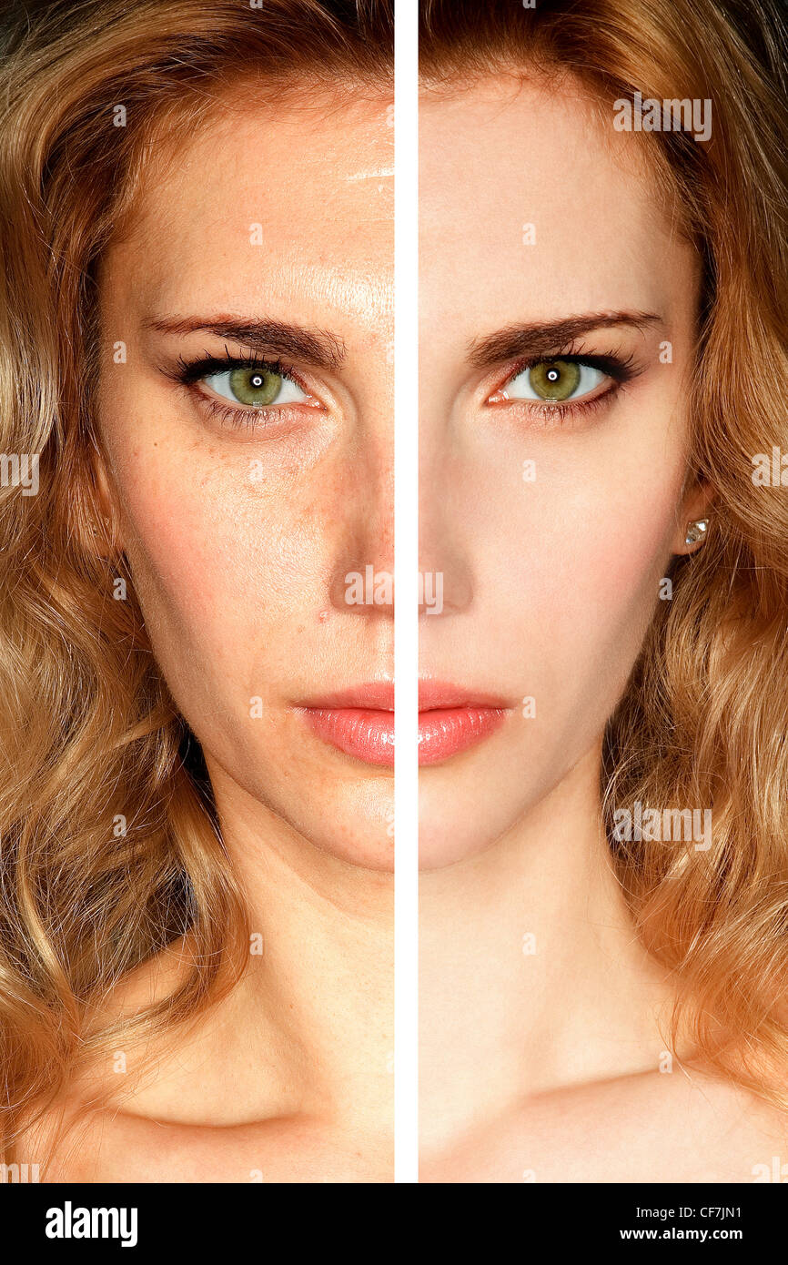 Weibchen mit welliges blondes Haar vor und nach der Gesichtsbehandlung Infobeauty Stockfoto