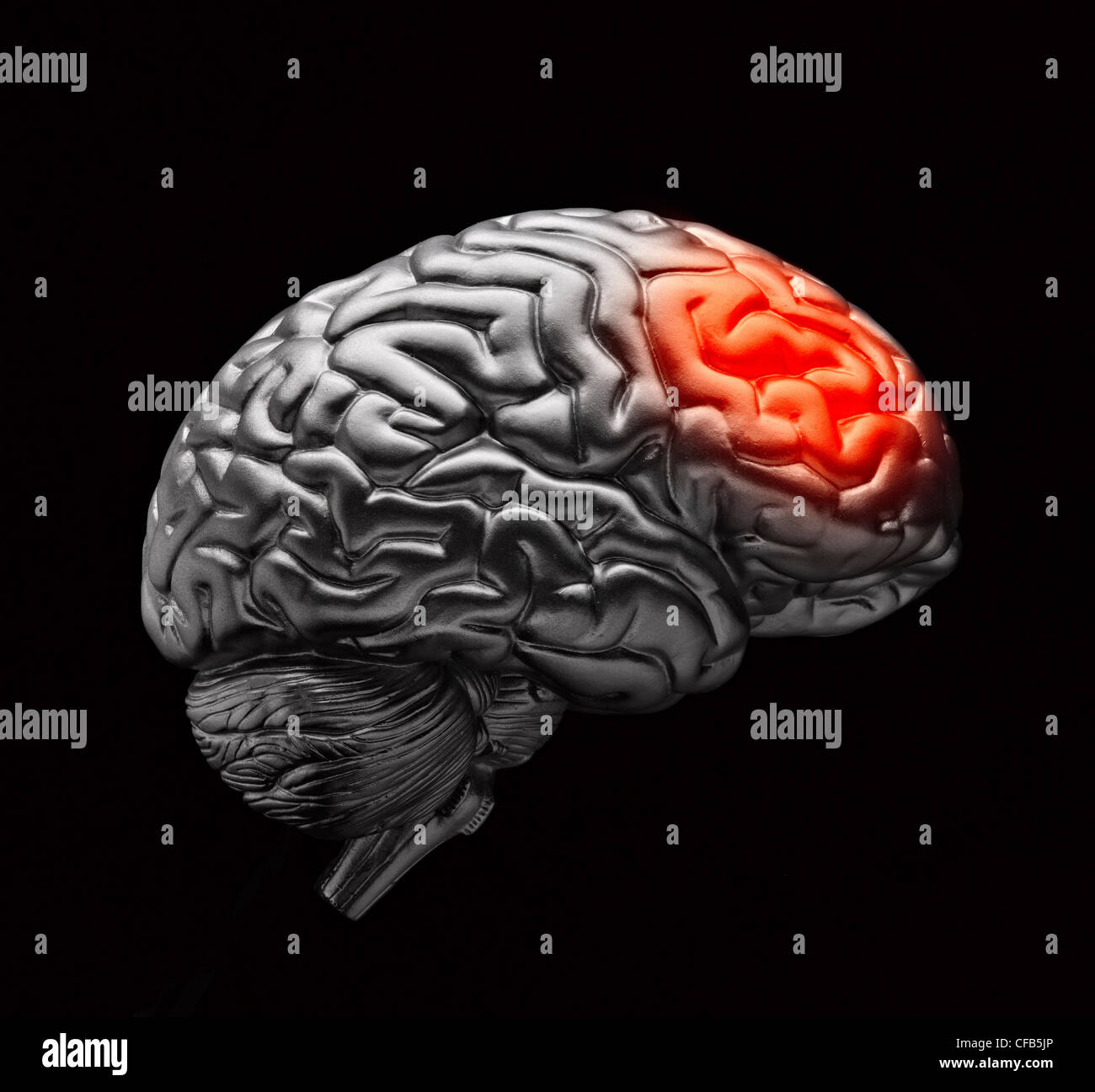Gehirn mit simulierten Kopfschmerzen Schmerzen Stockfoto