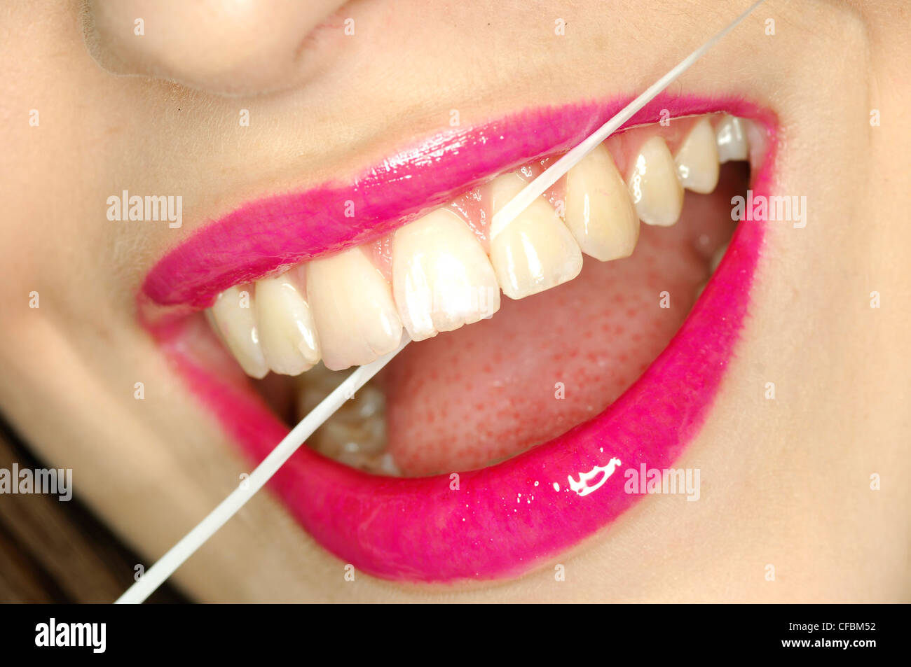 Nahaufnahme eines weiblichen Mund tragen leuchtend rosa Lipgloss mit Gewinde von Zahnseide durch Frontzähne Stockfoto