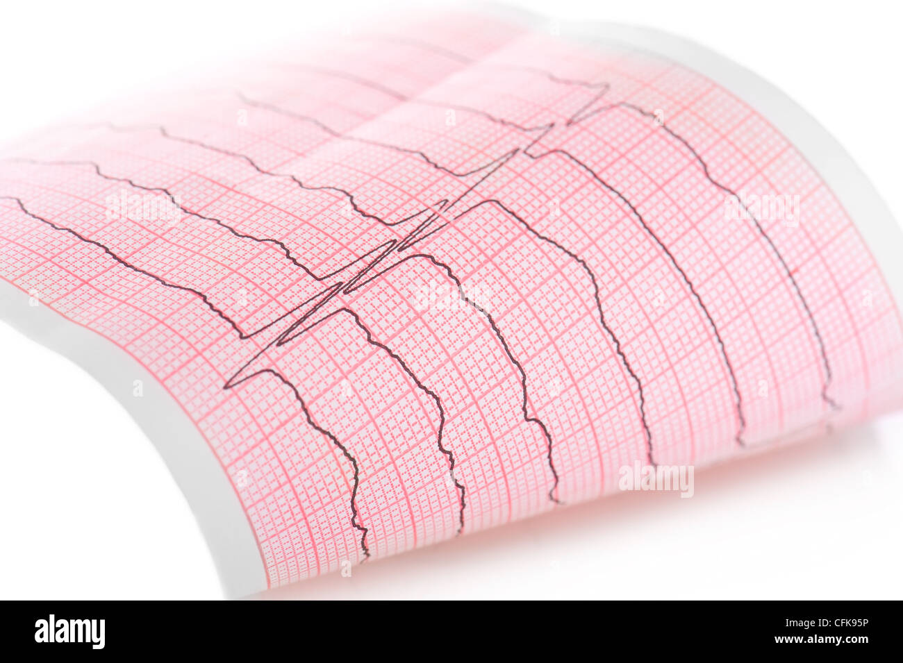 Kardiogramm. Makroaufnahme einer ECG graph Stockfoto