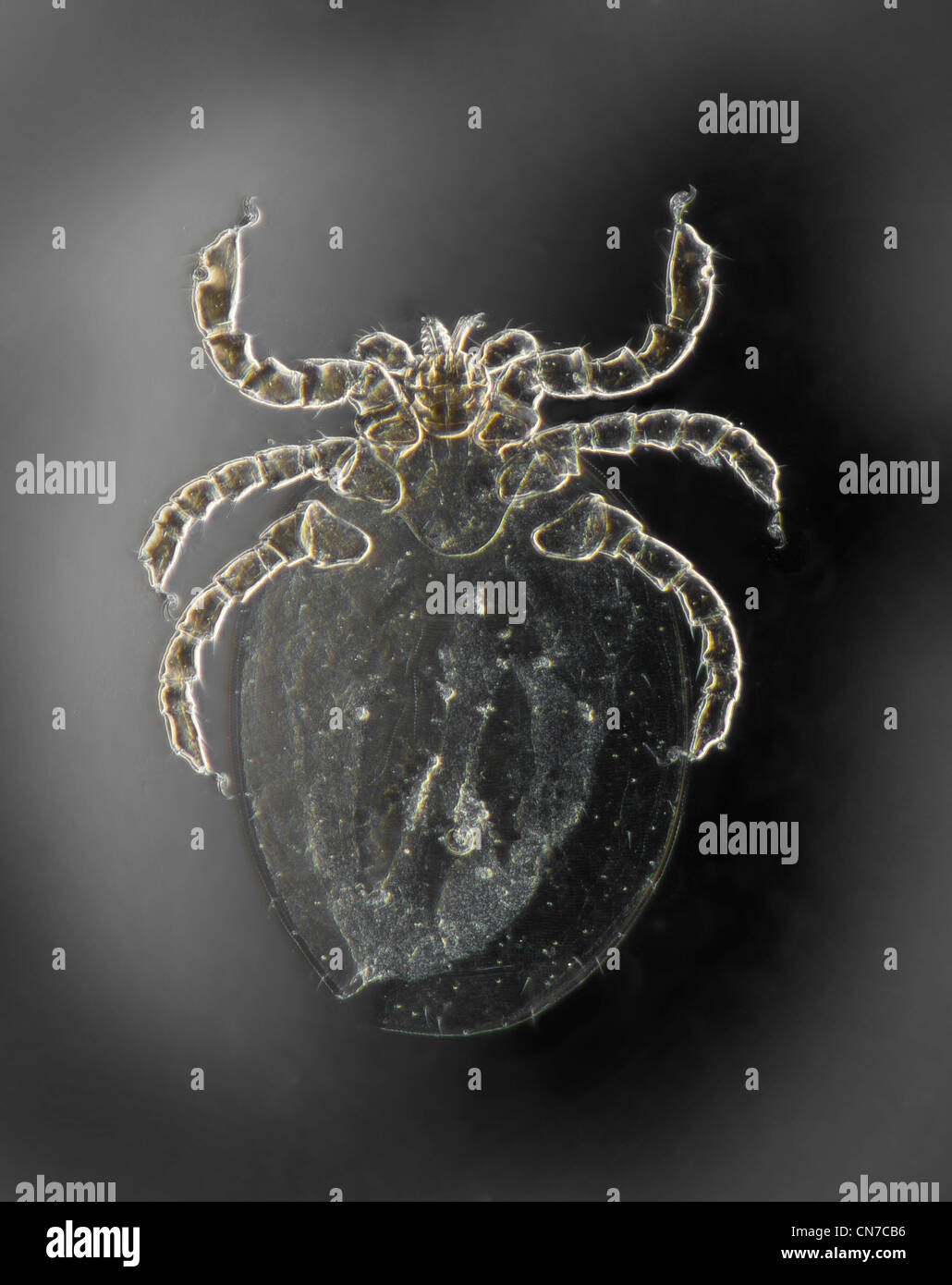 Dunkelfeld Mikrophotographie von einem aalartigen aus einem Wiesel (Mustela sp.) Stockfoto