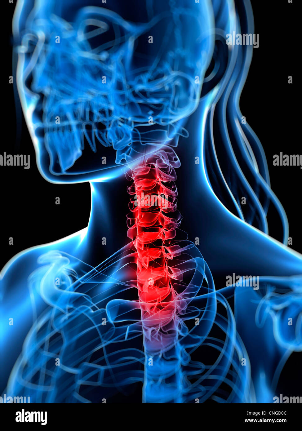Schmerzen im Rücken konzeptuellen Kunstwerk Stockfoto