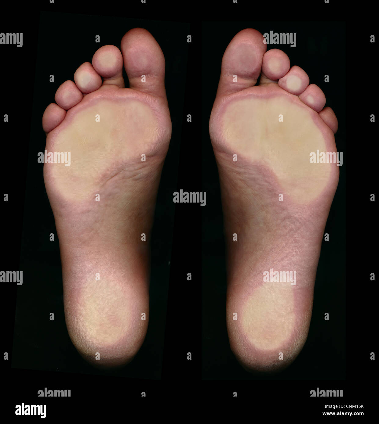 Füße von unten, Fussspuren Stockfoto