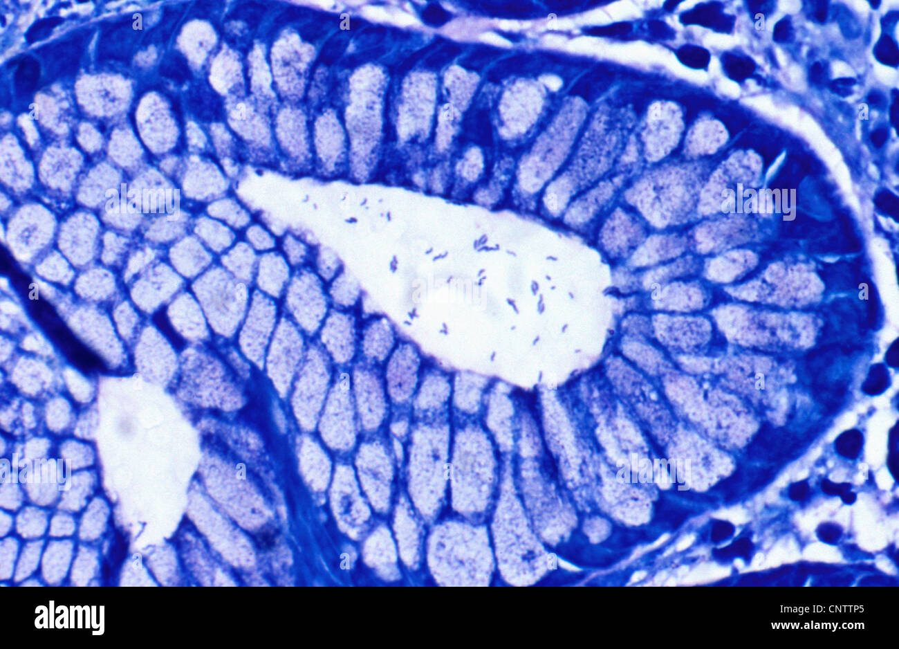Helicobacter Pylori in antral Krypta Stockfoto