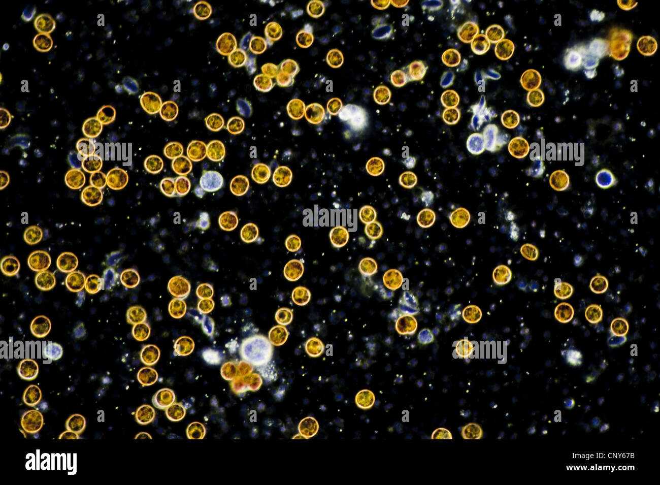 Mikroskopische Foto von symbiotischen Algen (Zooxanthellen) der Gattung Dinoflagellat Symbiodinium (SY: Gymnodinium).  Stichprobe aus einer weichen Korallen (Sinularia sp.) Stockfoto