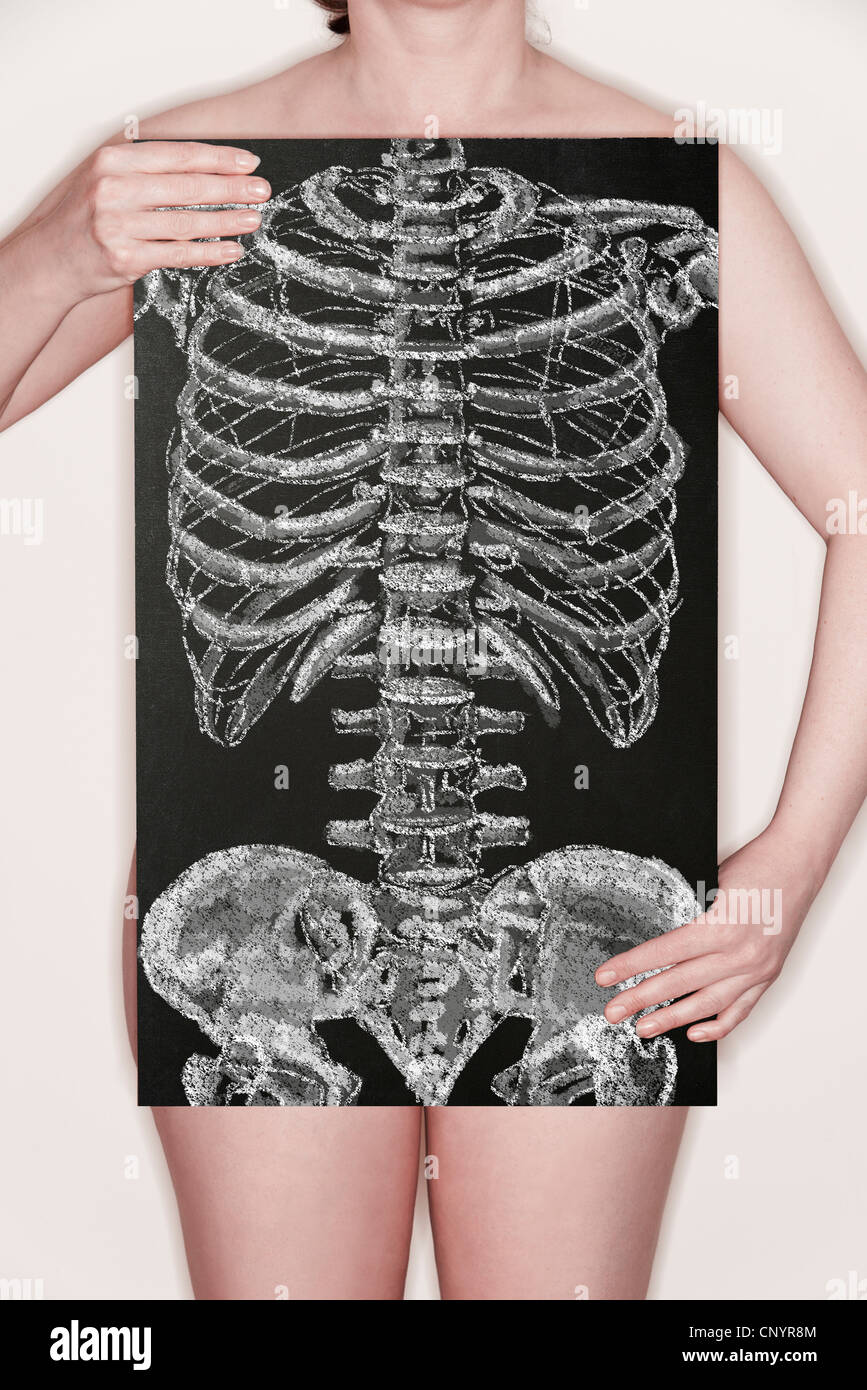 Frau mit einer Tafel mit einer Illustration von einem Skelett Torso in Kreide gezeichnet. Konzept Bild Stockfoto