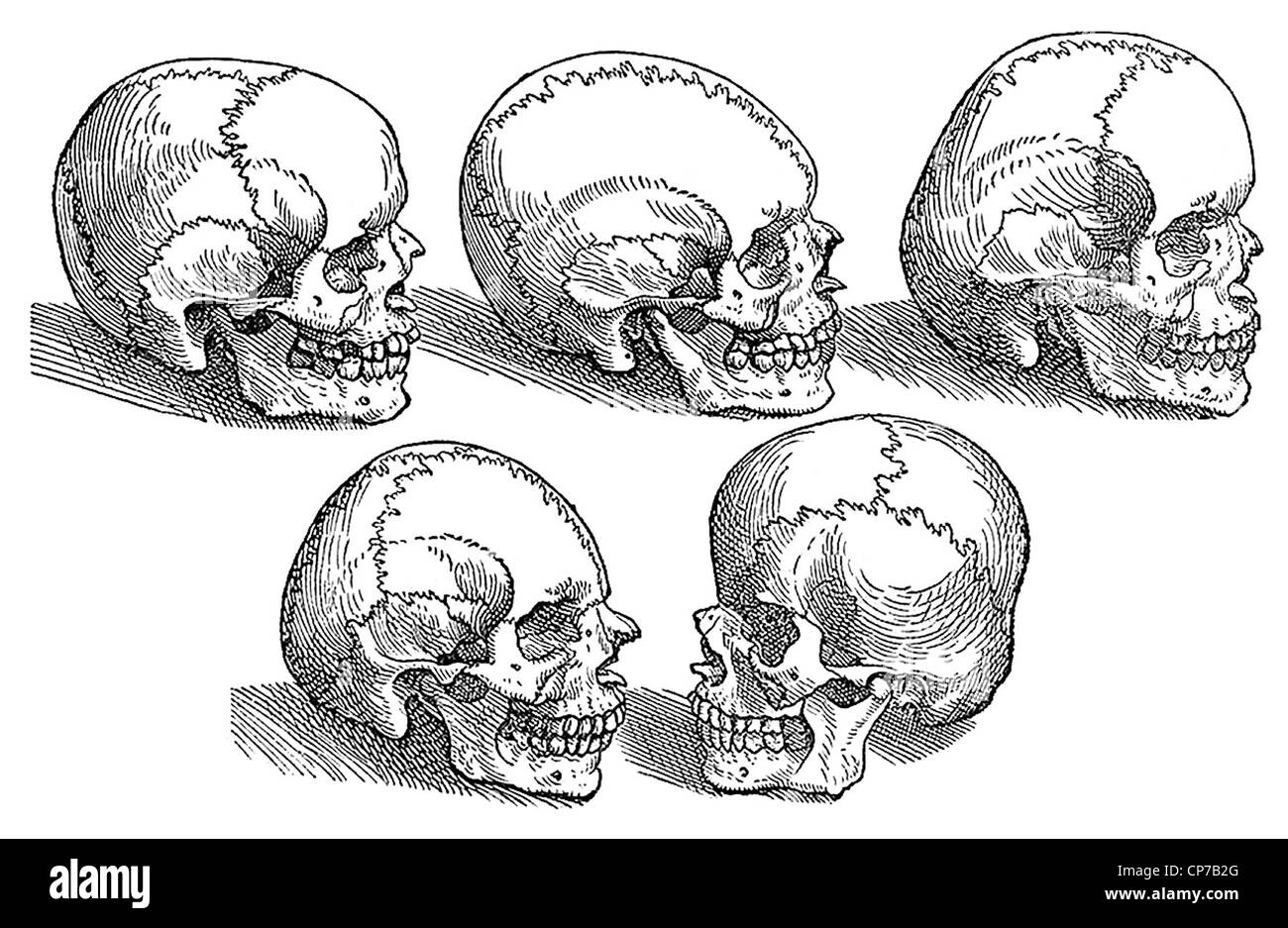 Illustration von fünf verschiedenen menschlichen Schädeln auf weißem Hintergrund. Stockfoto