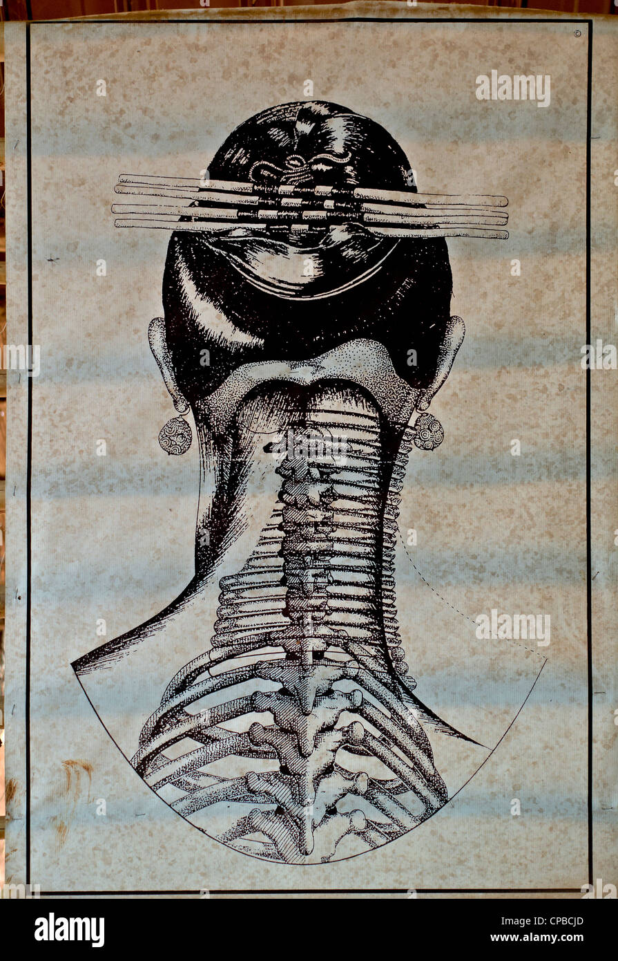 Anatomie Illustration der Schulterverzerrung der Ringplatzierung an den Frauen des nordthailändischen Hügelstammes mit langem Hals (Kayan). Stockfoto Anatomie Illustration der Schulterverzerrung der Ringplatzierung an den Frauen des nordthailändischen Hügelstammes mit langem Hals (Kayan). Stockfoto