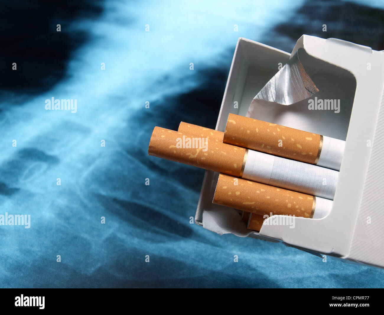 Schachteln Zigaretten mit Röntgenbild der Lunge im Hintergrund. Stockfoto