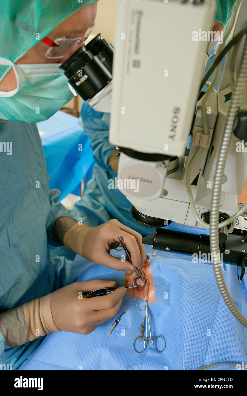 STRABISMUS, CHIRURGIE Stockfoto