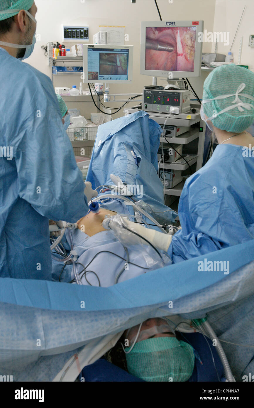 MYOMEKTOMIE Stockfoto