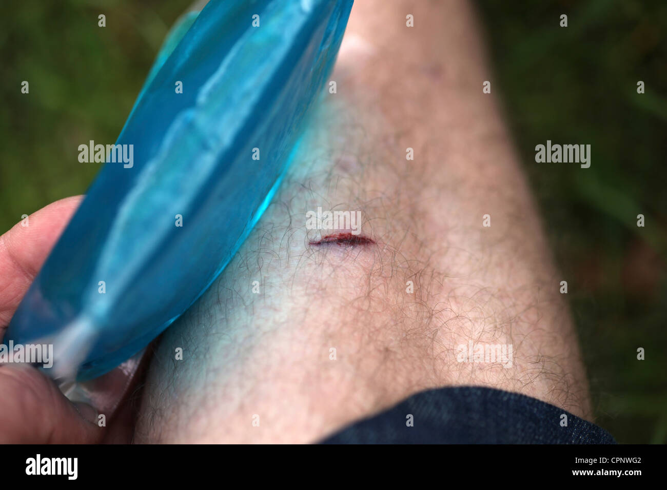 Plötzlich Offene Wunden Am Körper www.alamy.de