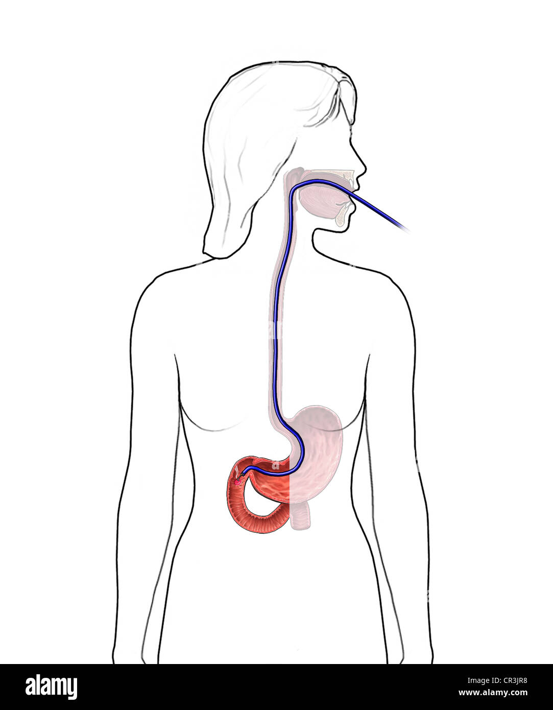 Querschnitt Des Magens Stockfotos und bilder Kaufen Alamy