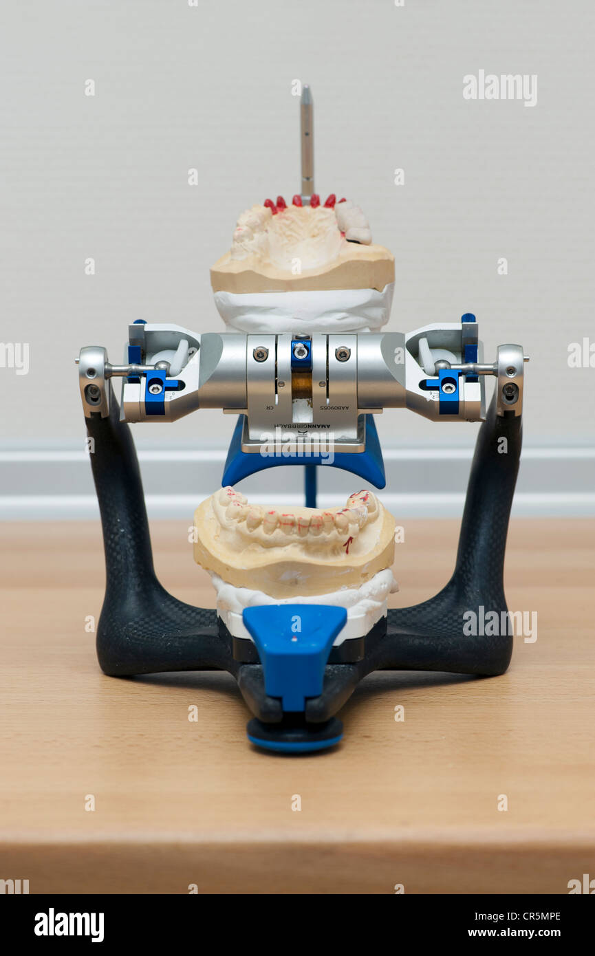 Ober und Unterkiefer Modelle im Artikulator Stockfotografie Alamy