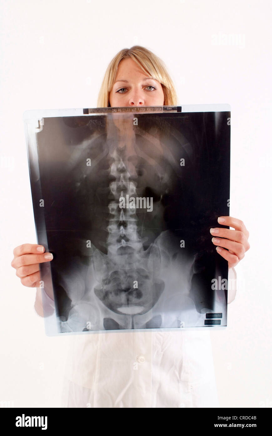 Frau Doktor mit Röntgen-backbone Stockfoto