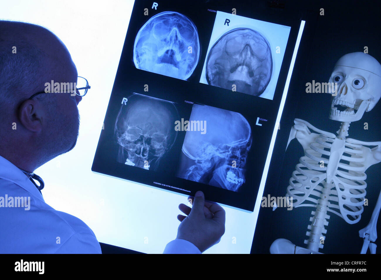 Arzt mit Röntgenaufnahme Stockfoto