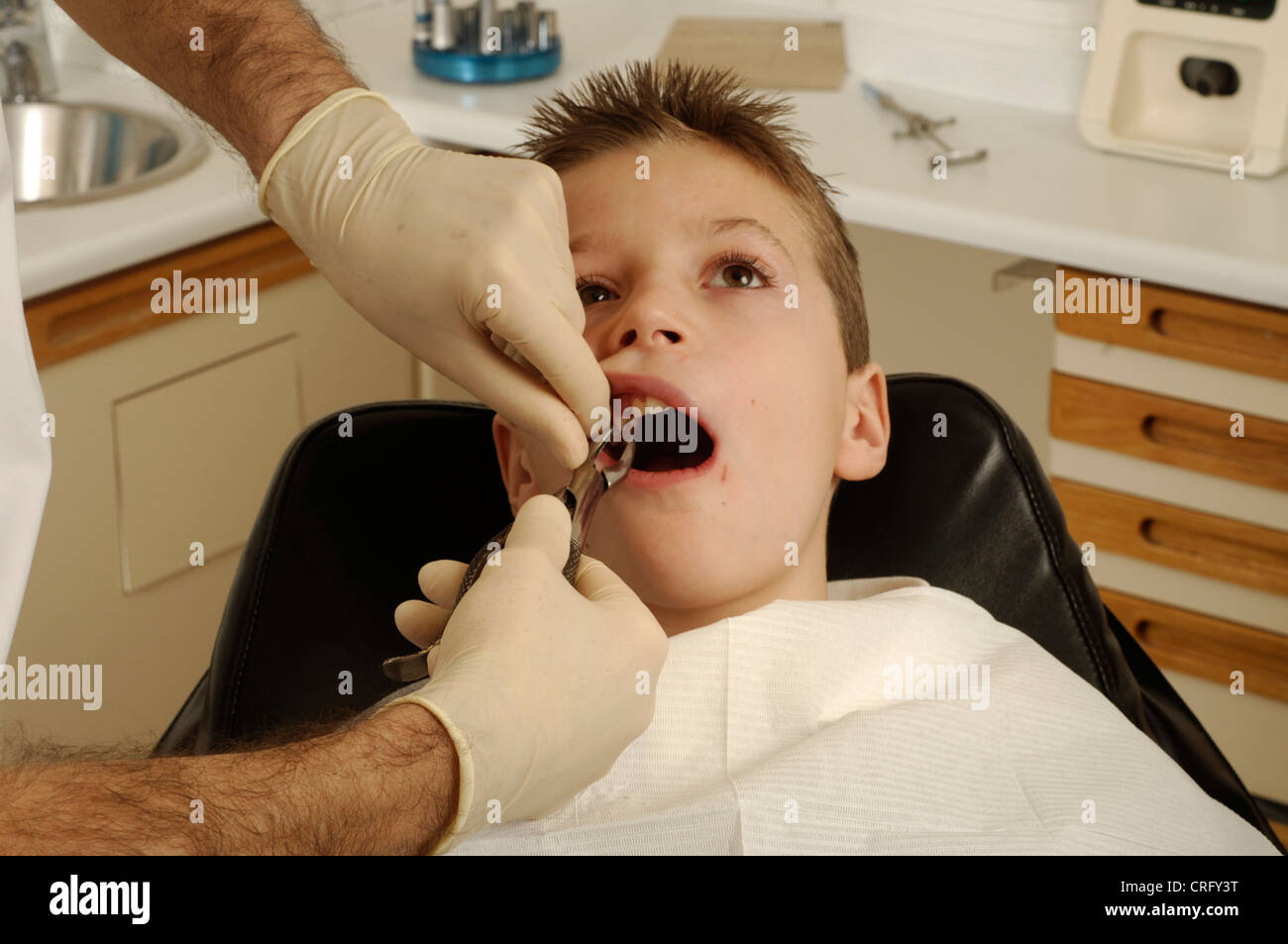 Ein Zahnarzt mit einer Edelstahl-Zange, um einen beschädigten Zahn aus dem Mund eines jungen Mannes zu entfernen. Stockfoto