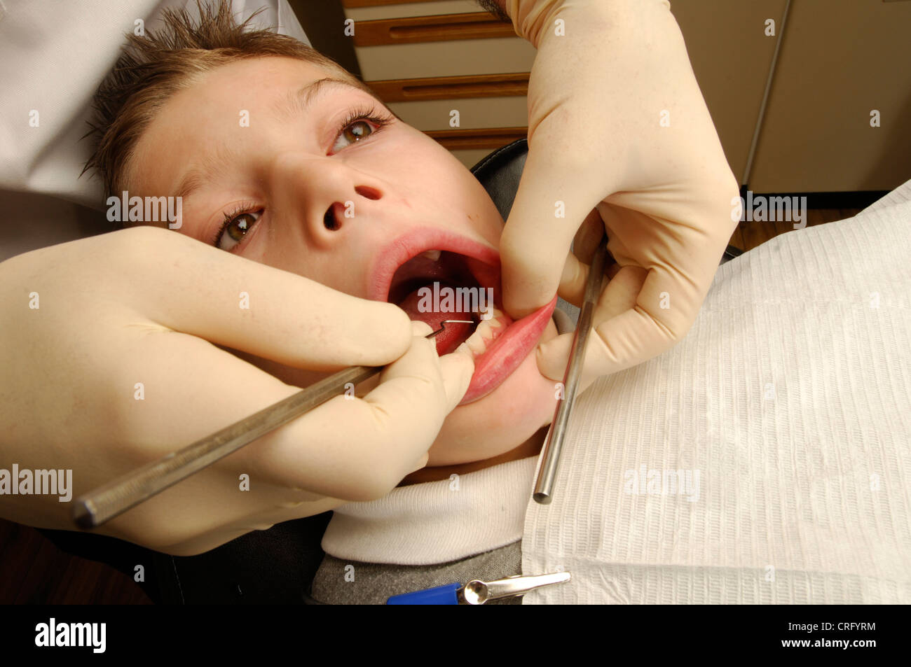 Ein Zahnarzt mit einem Pick einen jungen Zähne Plaque entfernen. Stockfoto