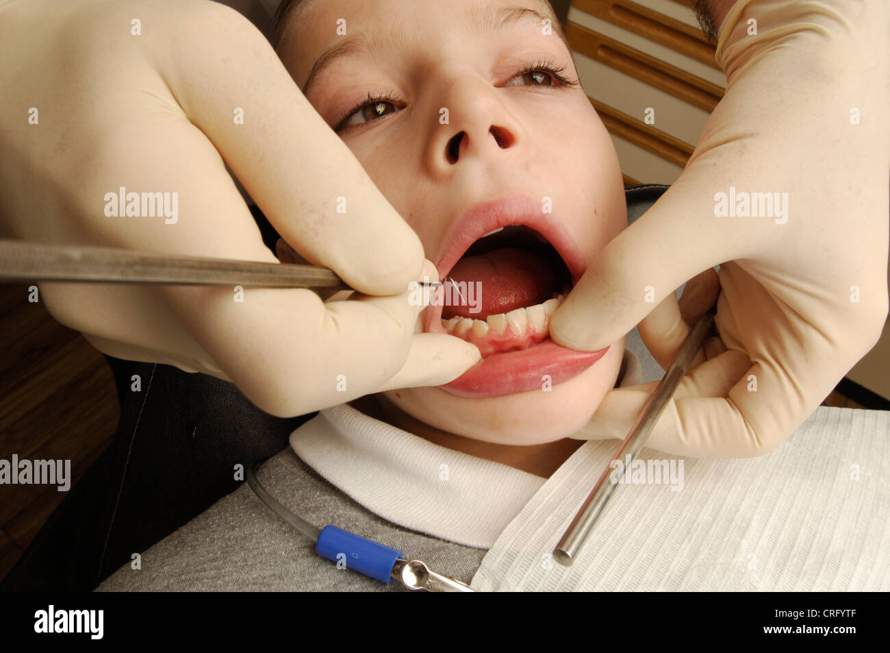 Ein Zahnarzt verwendet eine dental Pick entfernt Plaque von den Zähnen eines jungen männlichen Patienten zu kratzen. Stockfoto