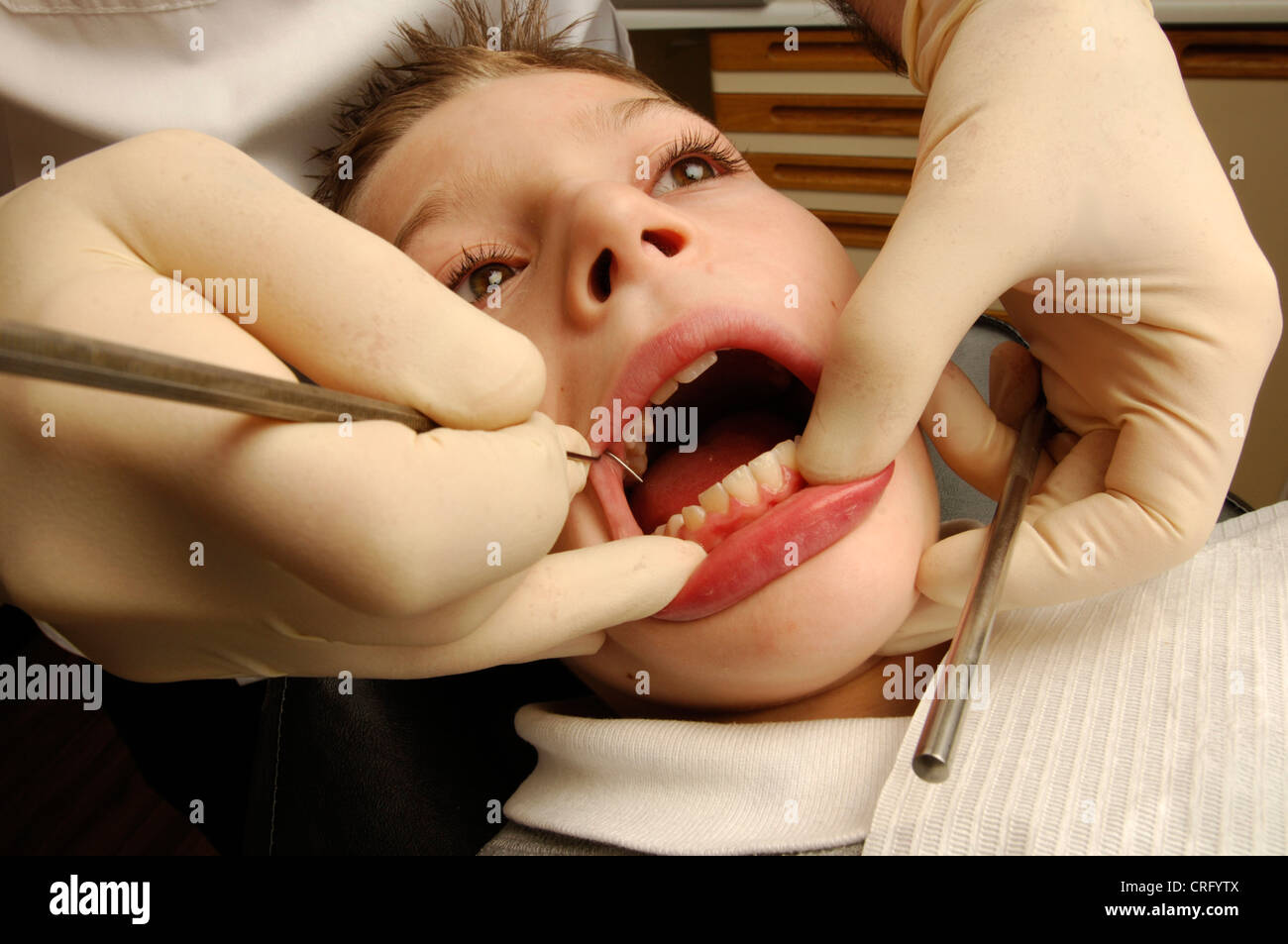 Ein Zahnarzt schabt entfernt Plaque von den Zähnen eines jungen männlichen Patienten. Stockfoto