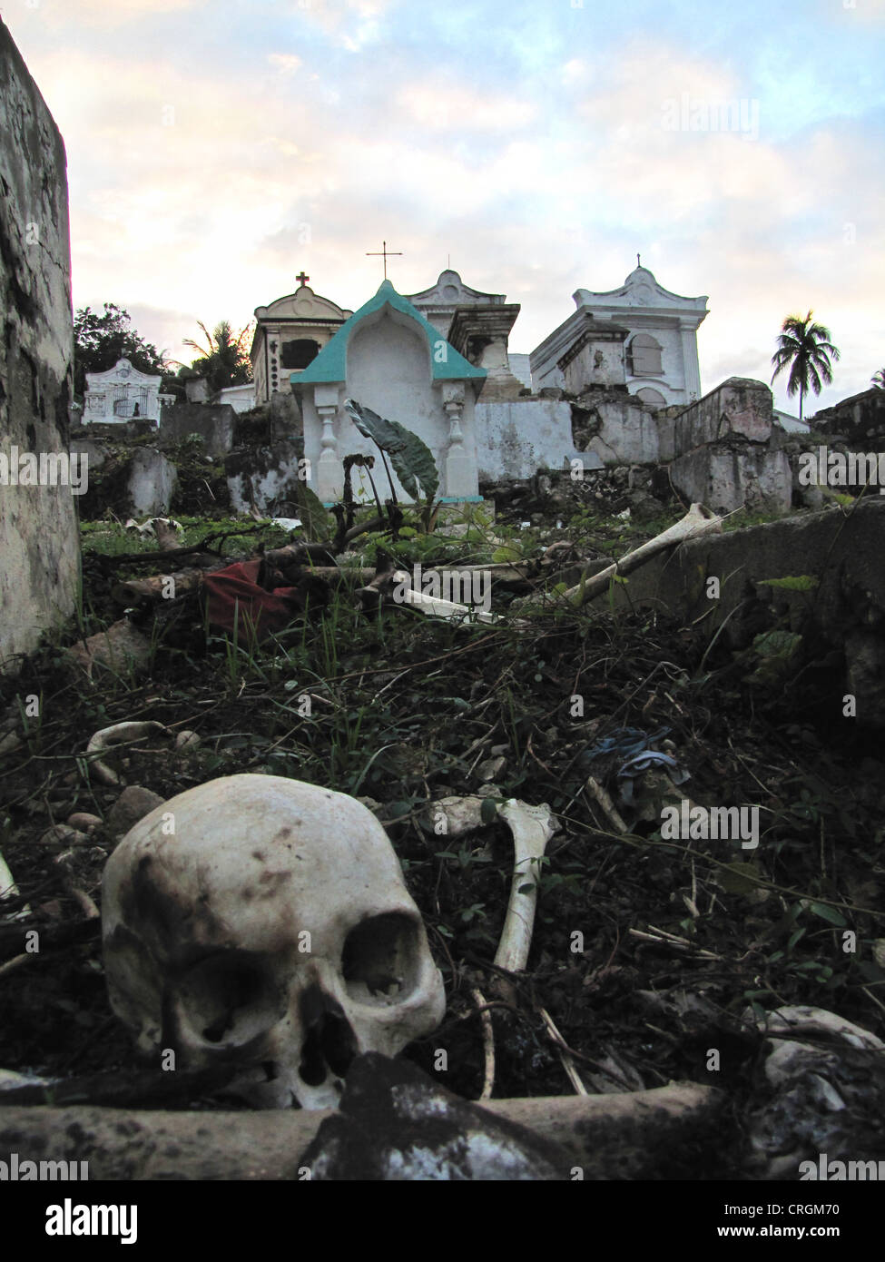 Verbrannte Menschliche Knochen Stockfotos Und Bilder Kaufen Alamy