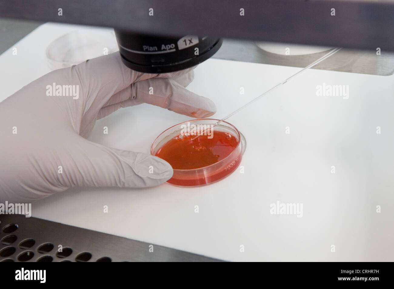 Vor der Implantation und während Hormontherapie CT Scans durchgeführt, um weibliche Patienten Eierstöcke kontrollieren. Stockfoto