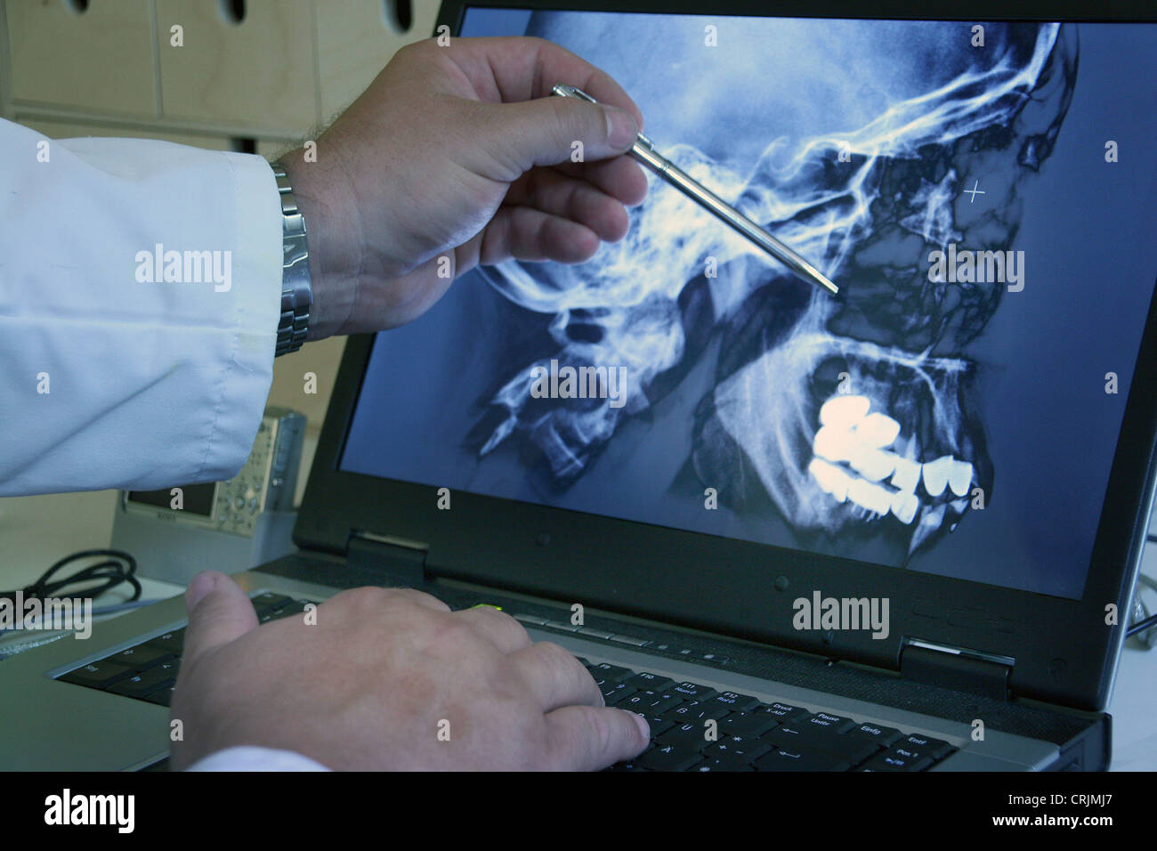 Menschen, Menschen, Menschen (Homo Sapiens sapiens) Arzt eine Röntgenaufnahme des Schädels Stockfoto