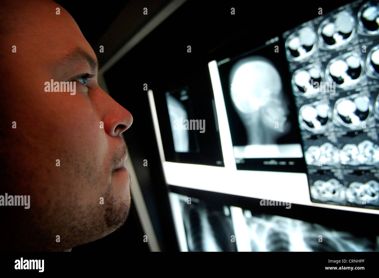 Ein Arzt überprüft eine Reihe von Röntgen-Bildern auf einem Leuchttisch. Stockfoto