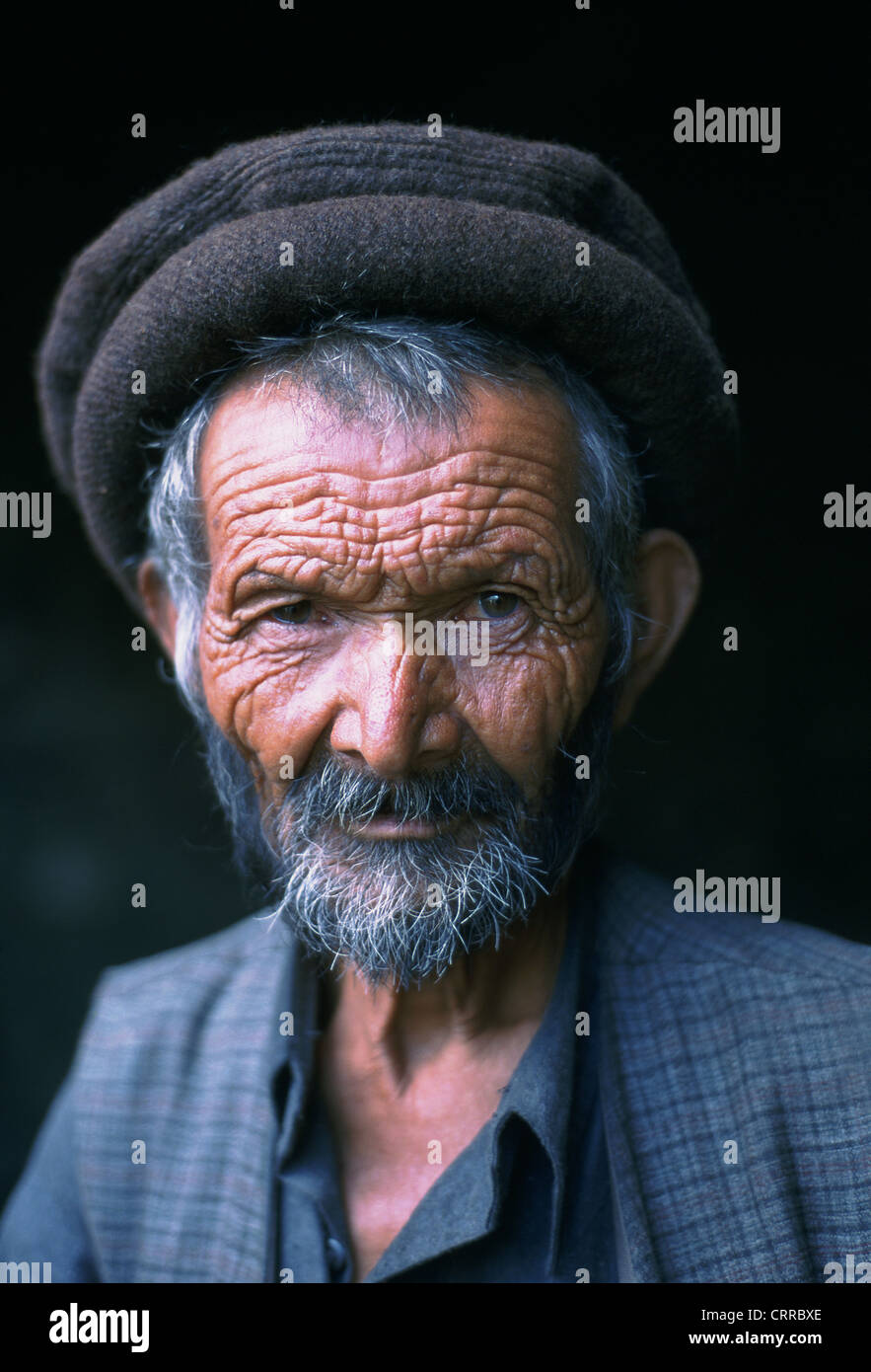 Mann leidet unter Kretinismus, eine angeborene Erkrankung durch den Mangel an Schilddrüsenhormonen (Pakistan) Stockfoto