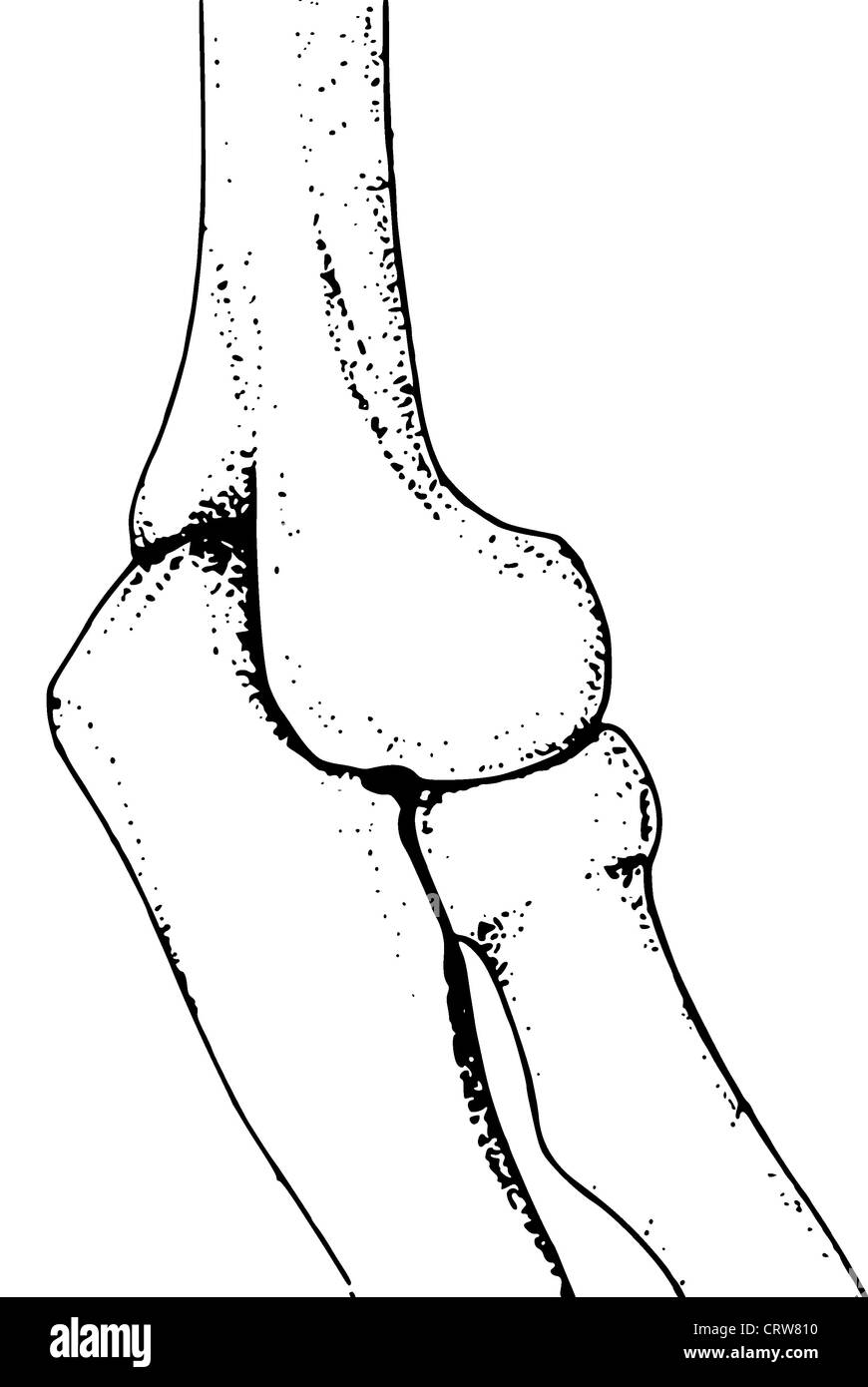 Knochen des menschlichen Arms Stockfoto