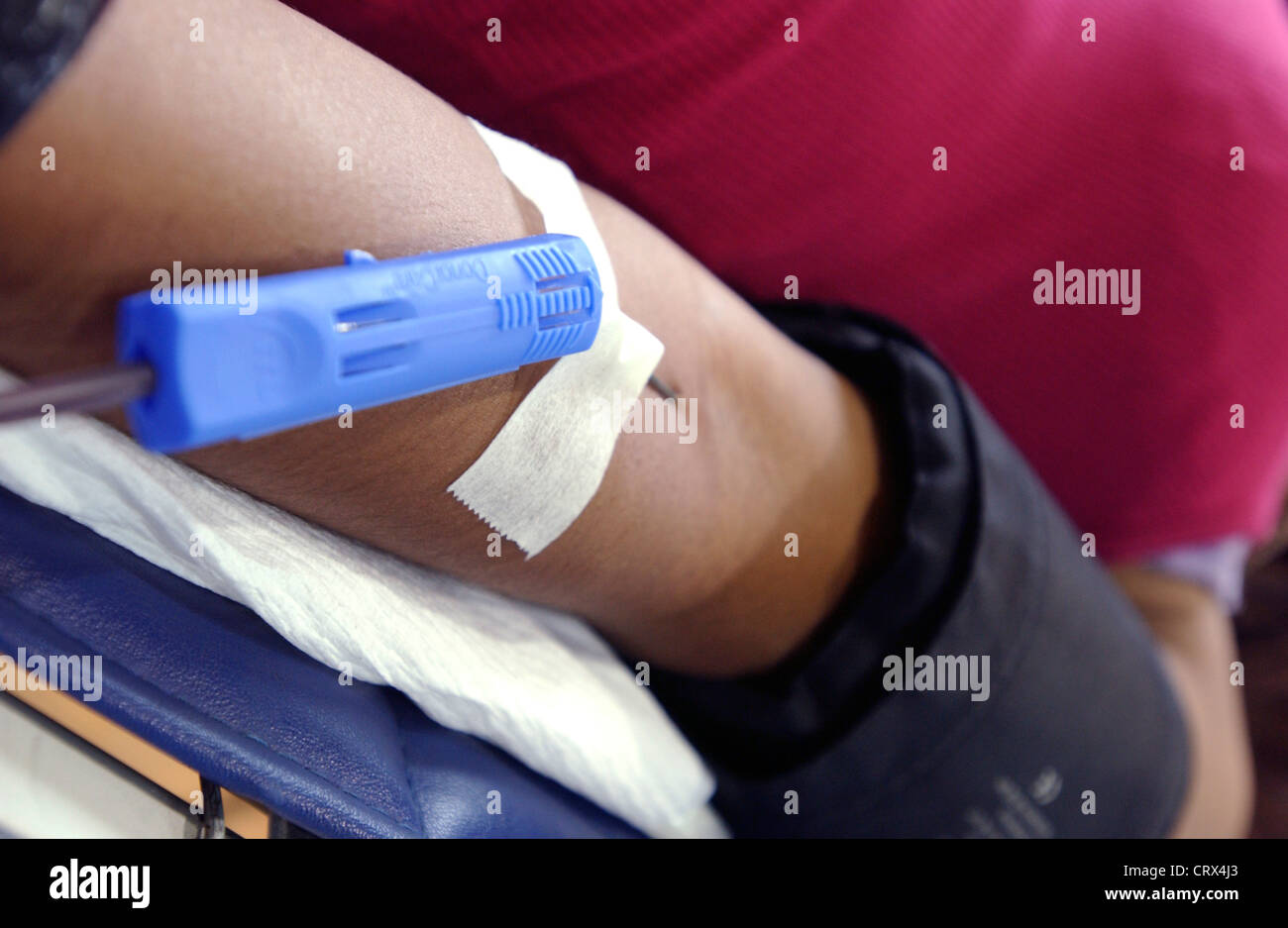 Eine Kanüle in den Arm der Blutspender eingefügt. Stockfoto