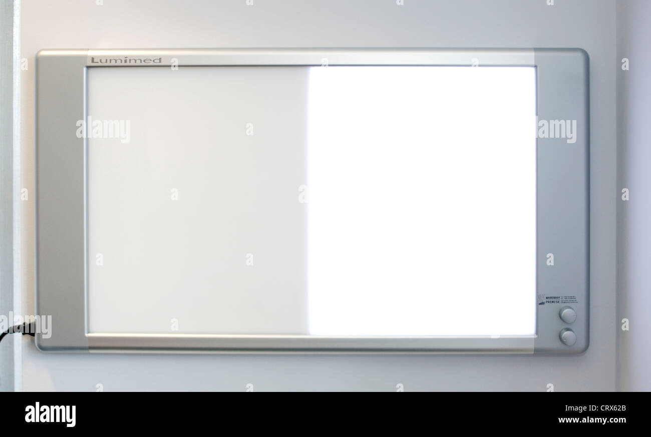 Ein Arzt Wand-Bildschirm zur Überprüfung des Patienten Scan Nd Röntgenstrahlen Stockfoto