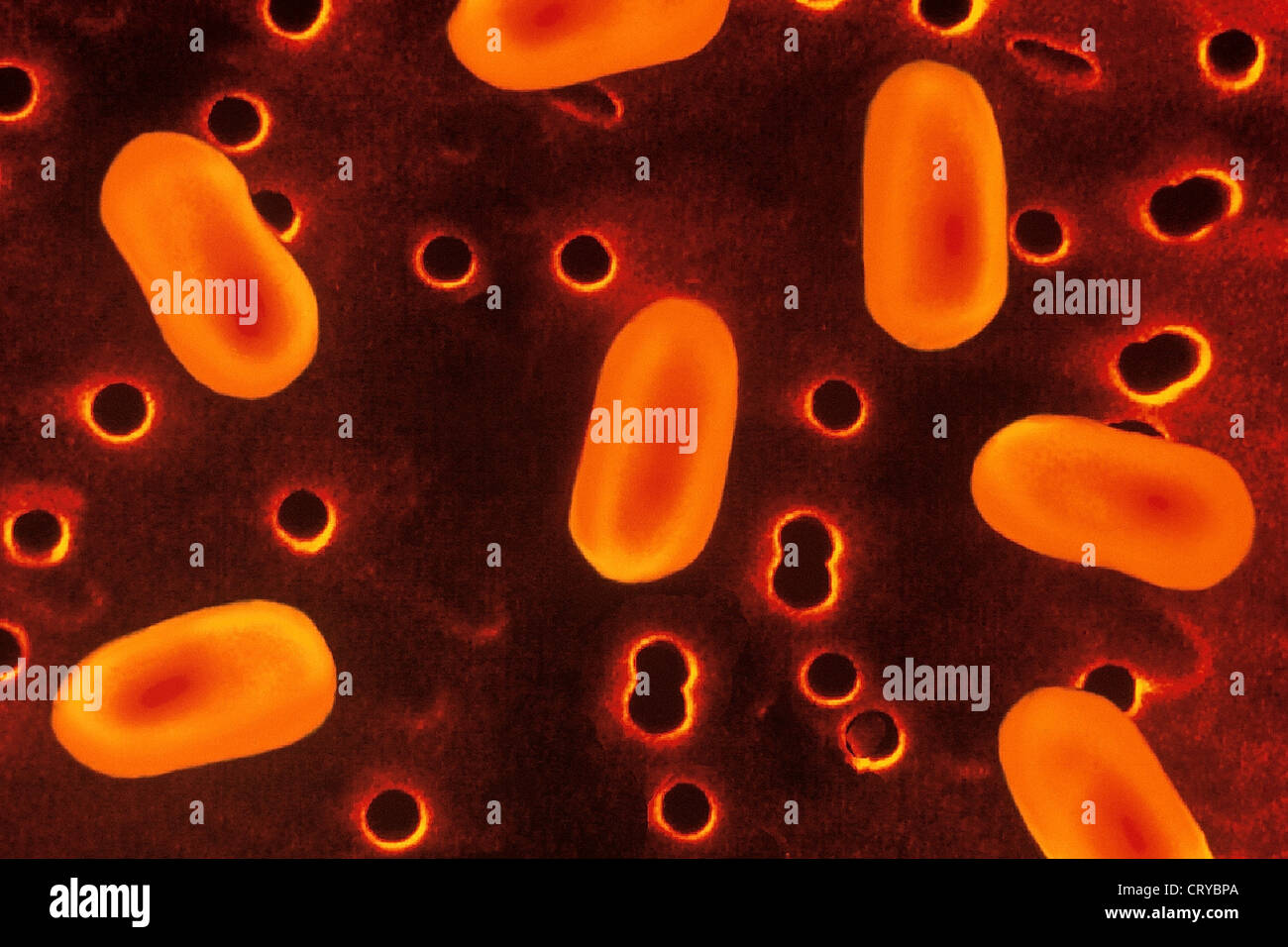 HAEMOPHILUS INFLUENZAE Stockfoto