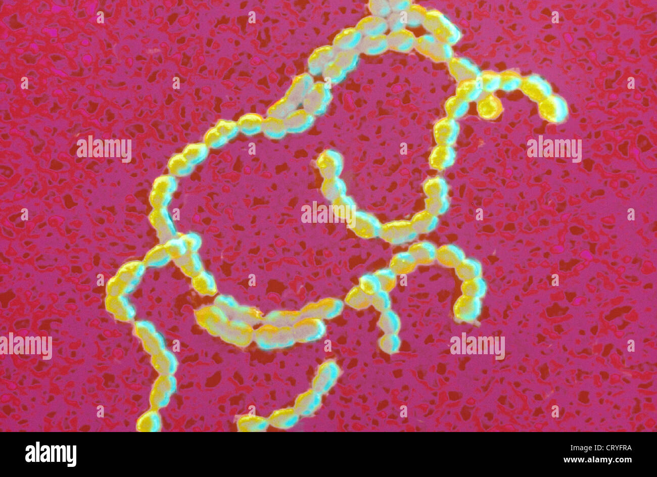 Streptococcus hemolyticus Fotos und Bildmaterial in hoher Auflösung