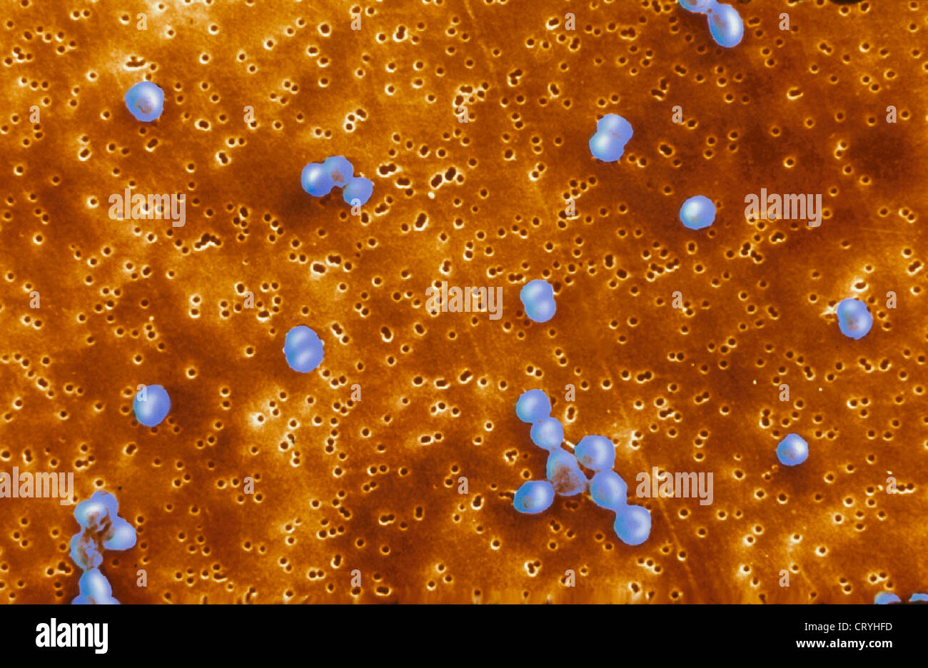 MORAXELLA CATARRHALIS Stockfoto