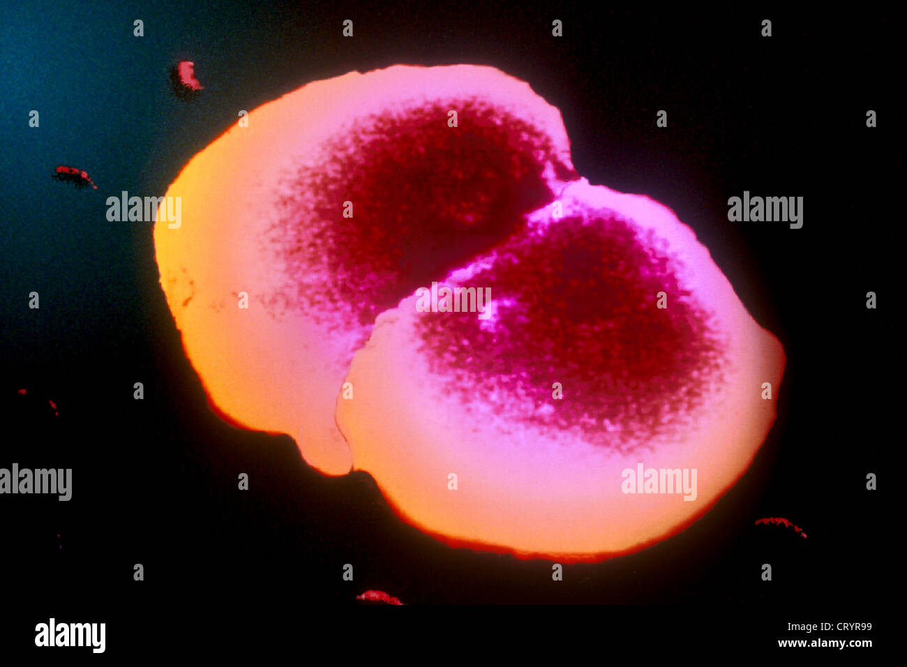 NEISSERIA GONORRHOEAE Stockfoto