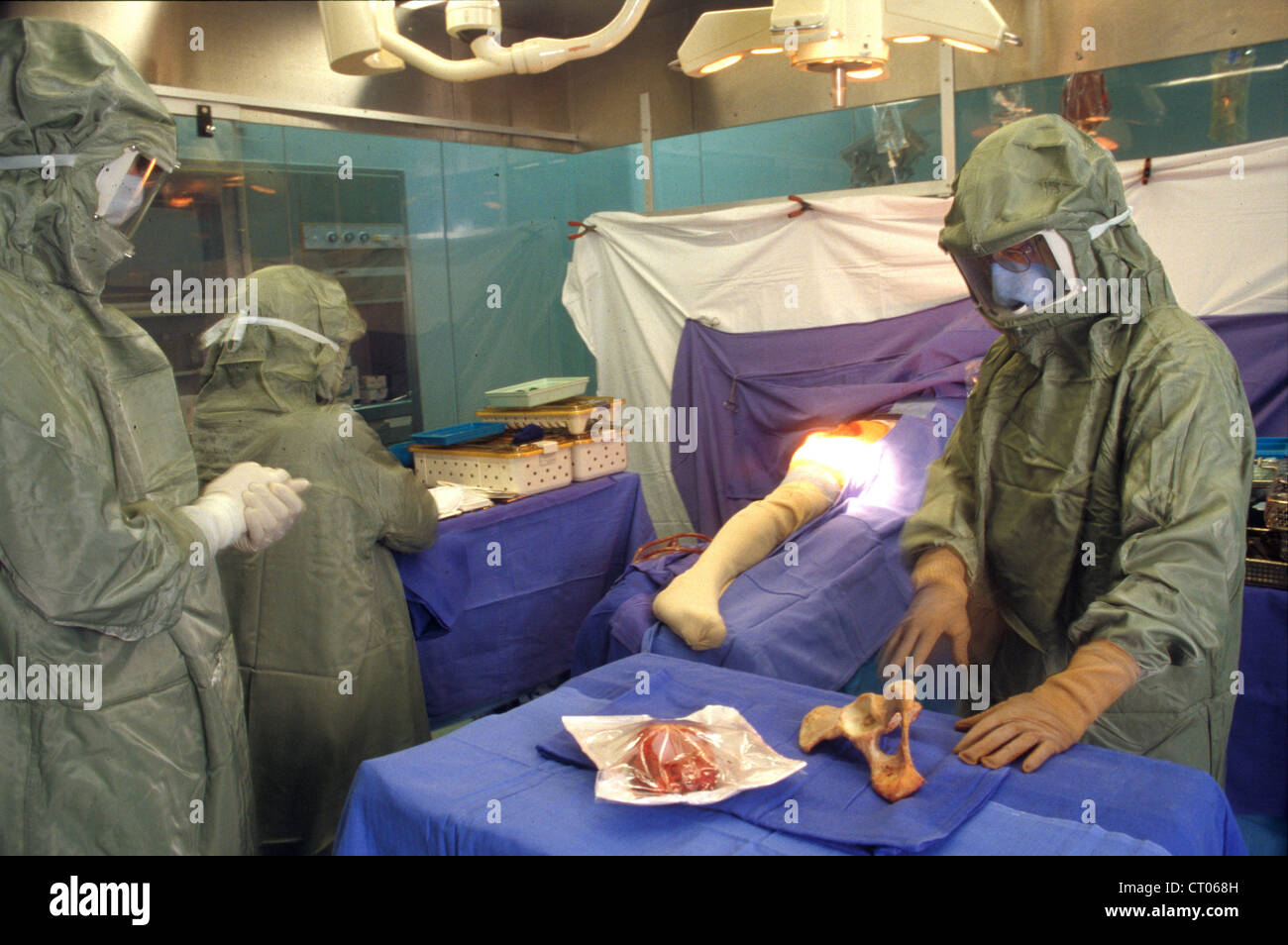 HIP-TRANSPLANTATION Stockfoto