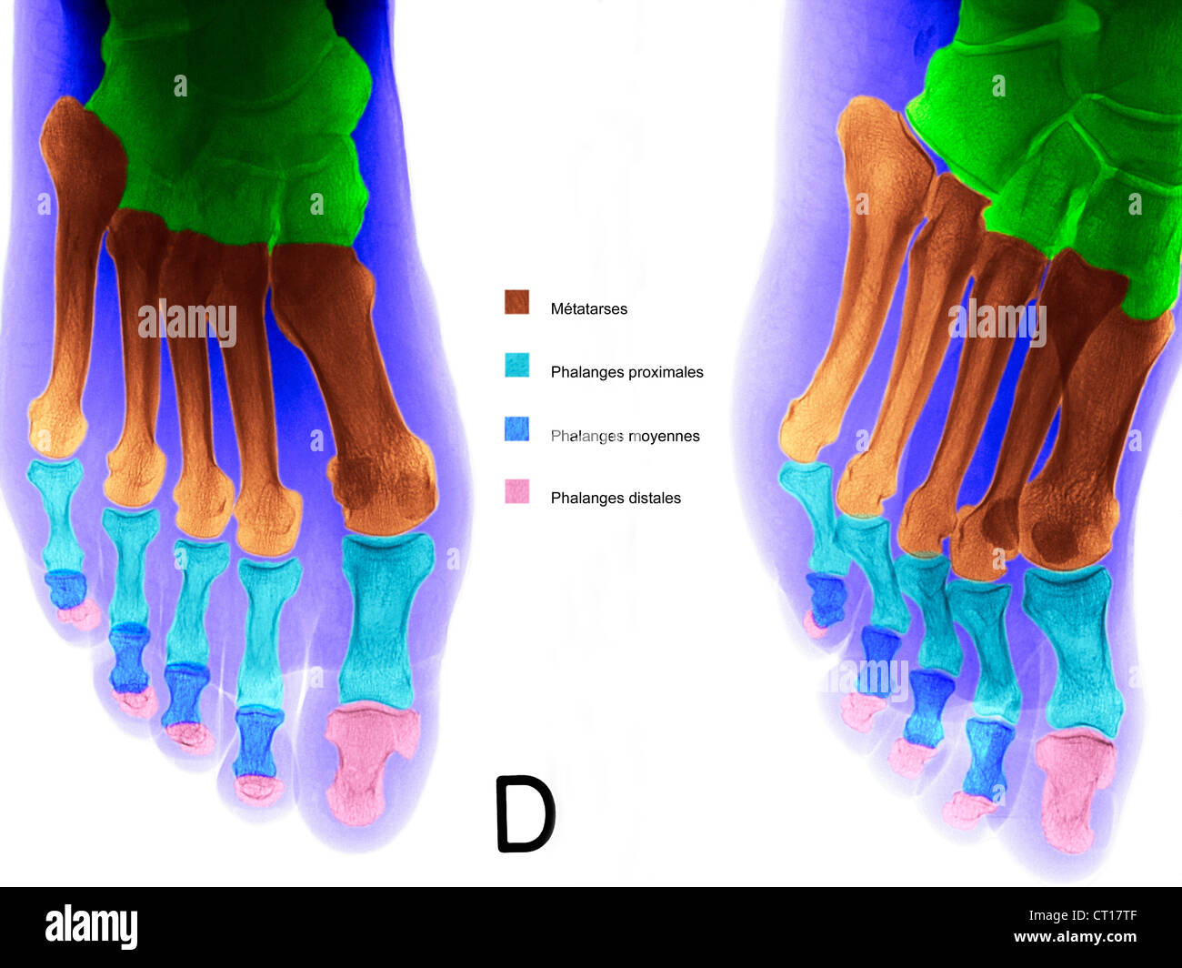 Drittes glied -Fotos und -Bildmaterial in hoher Auflösung – Alamy