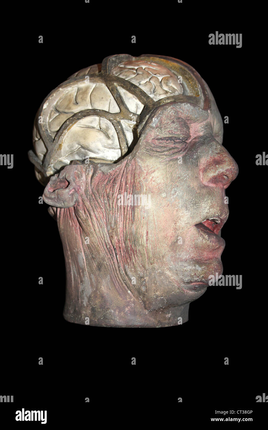 Anatomisches Wachsmodell mit einem Teil des Schädels entfernt auszusetzen Gehirn Stockfoto