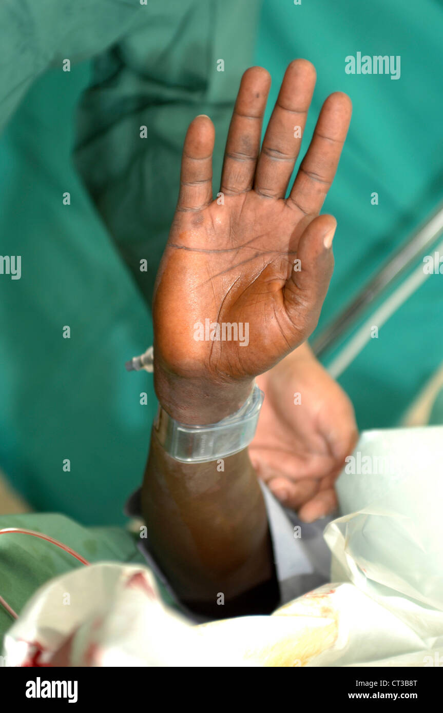 Patienten Hand erhoben für die Durchblutung Stockfoto