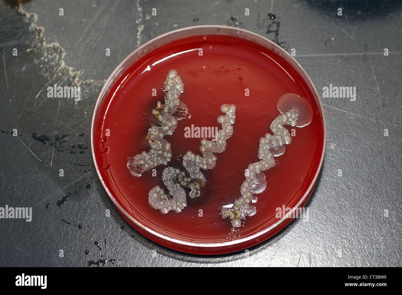 Bakterienkultur wächst in einer Petrischale auf Agar Gelee. Stockfoto