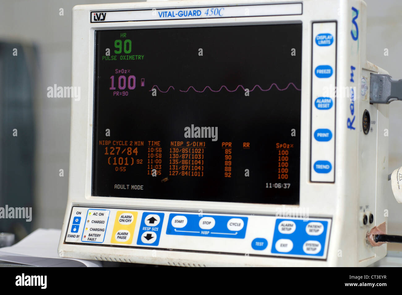 Vitalparameter-Monitor verwendet während der Operation Patienten kardiovaskulären und respiratorischen Funktionen zu überwachen. Stockfoto
