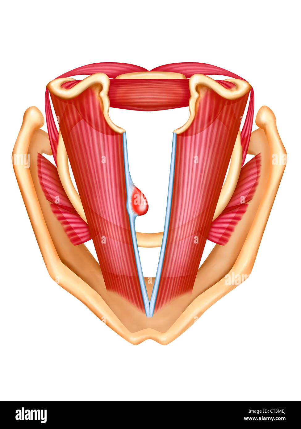 STIMMBAND-POLYP Stockfoto